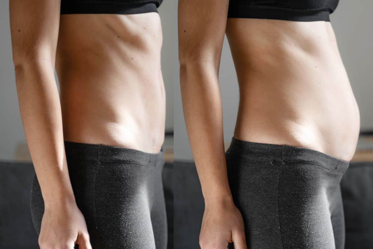 How long does diastasis recti take to improve Chandlers Green?