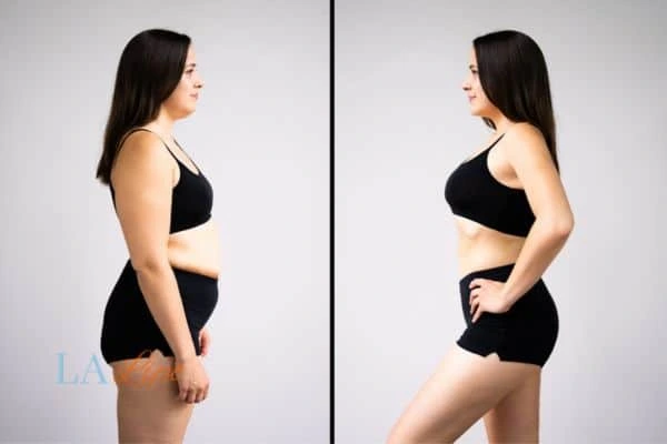 Picture of womans before and after using LA-EMS body sculpting to improve her core strength Chandlers Green