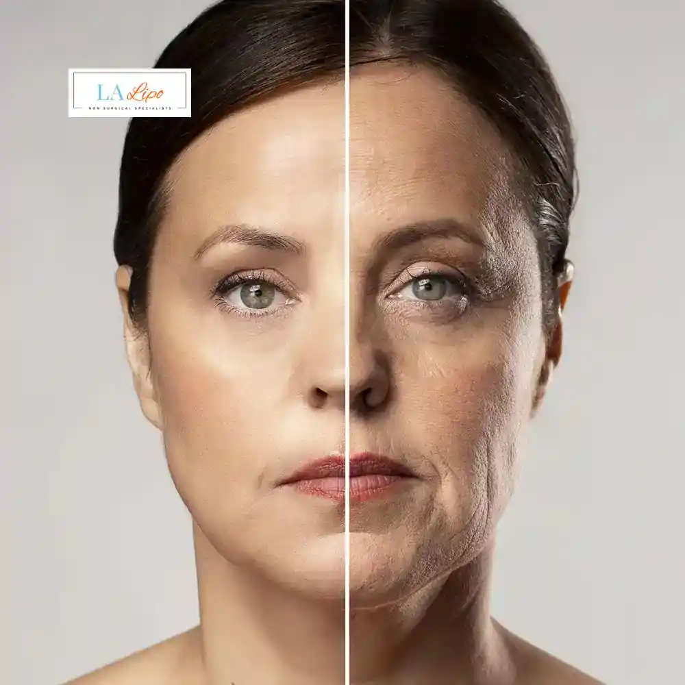 How Can You Tell If Non-Surgical Skin Tightening Is Right for You Chandlers Green?