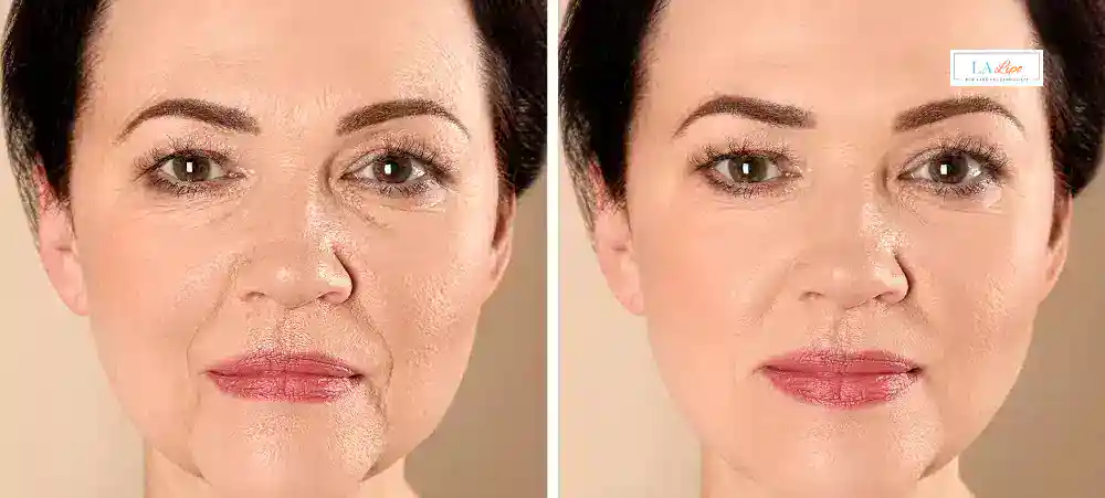 Why Aren’t My Skincare Products Making My Sagging Skin Look Firmer Chandlers Green?