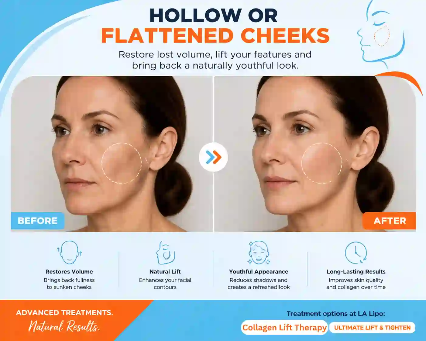 Sign #4: Hollow or Flattened Cheeks Chandlers Green