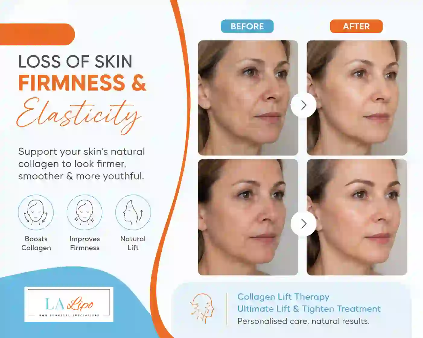 Sign #7: Loss of Skin Firmness and Elasticity Chandlers Green