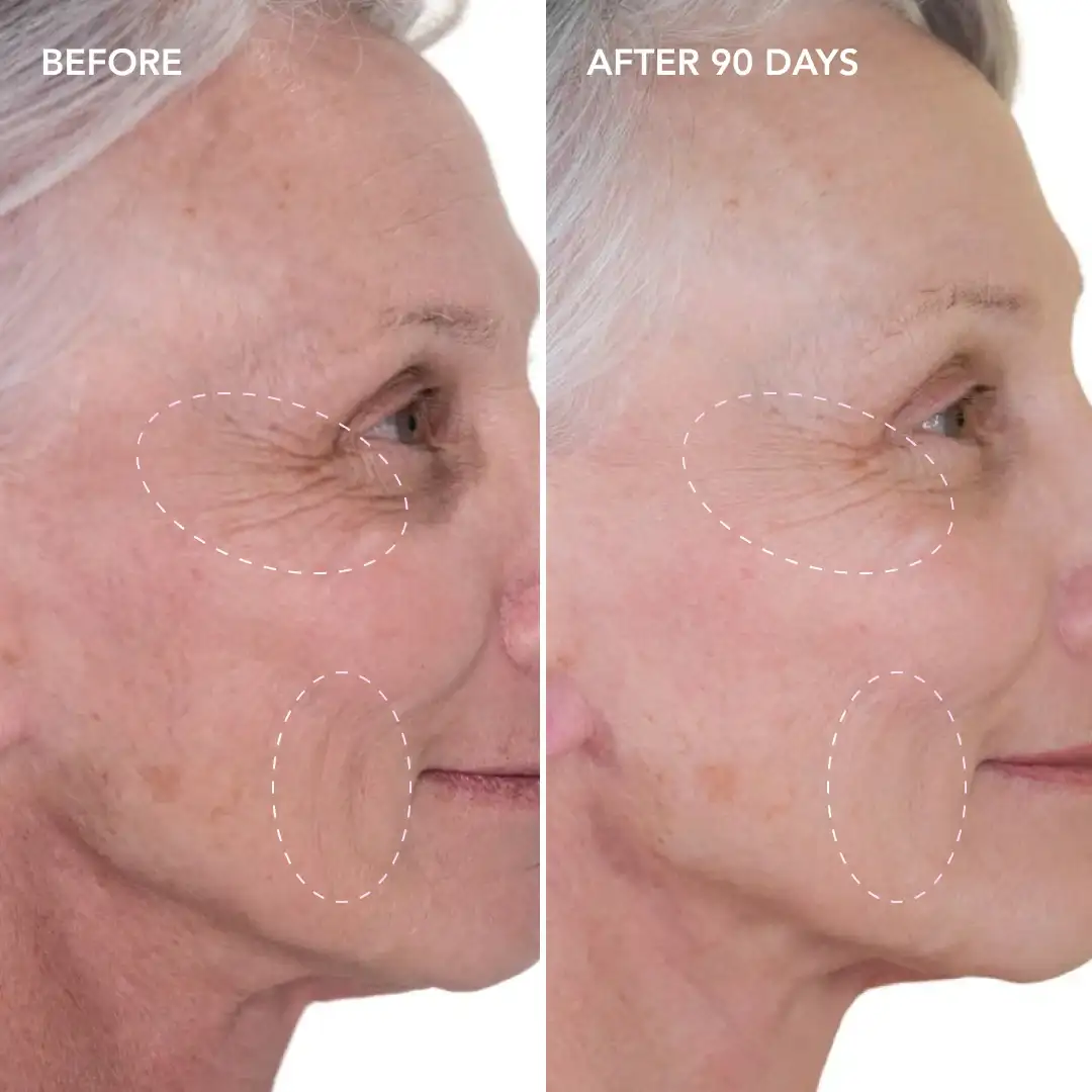 When will you see results Chandlers Green